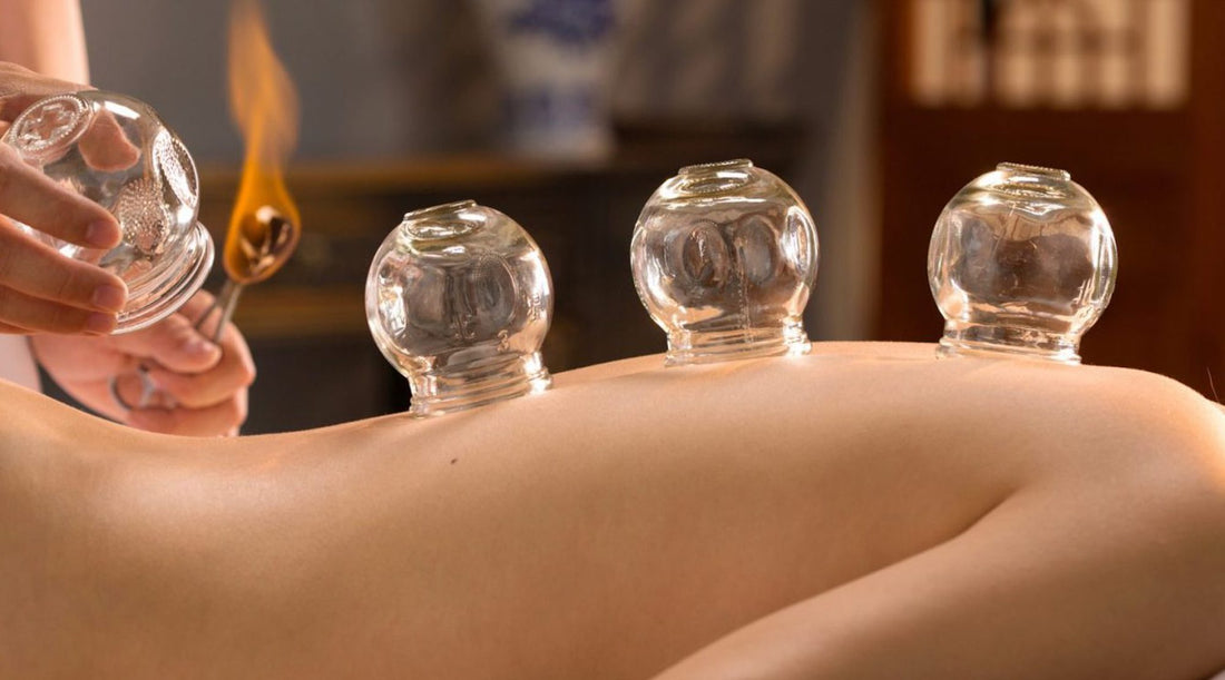 THE ART OF CUPPING