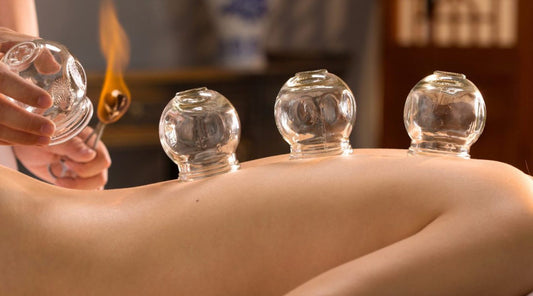 THE ART OF CUPPING